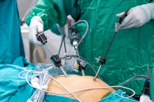 Procedures for Recovery Outcomes